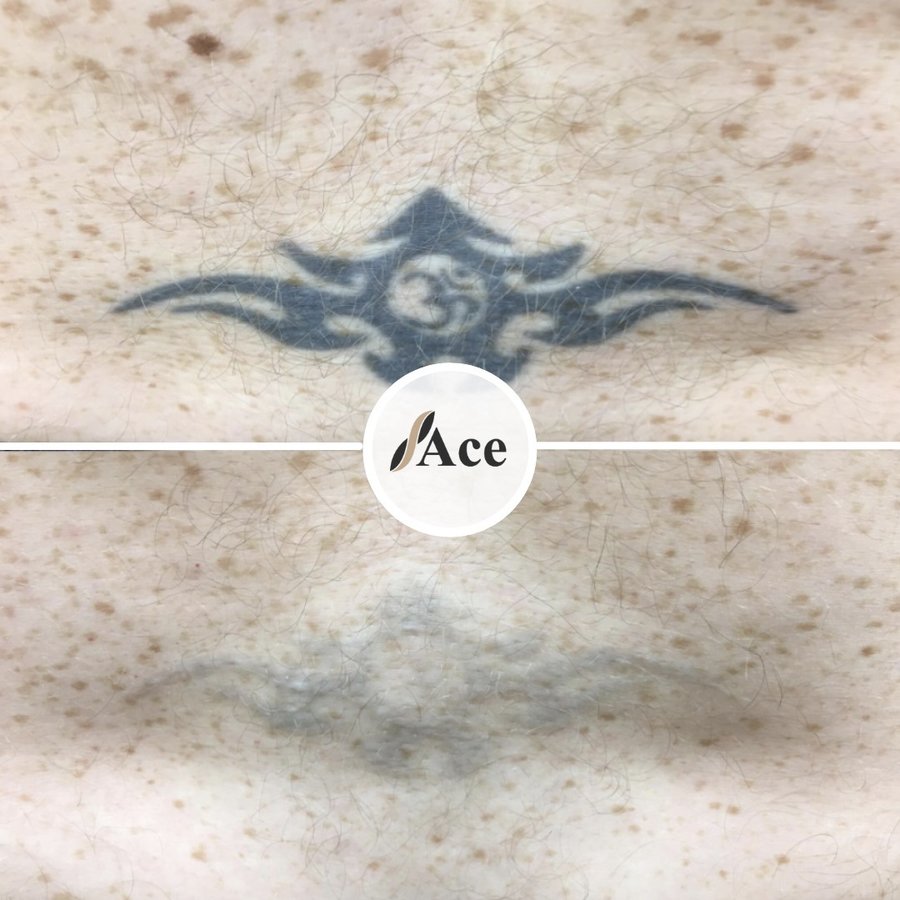 Ace Aesthetics - Ace Aesthetics